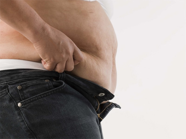 Na léčbu obezity vynakládá ČPZP ročně až 40 milionů korun