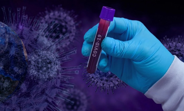 Národní strategie testování nemoci COVID-19 komplexně řeší přístup k testování a definuje páteřní síť laboratoří a odběrových míst