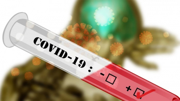 Firmy a organizace mohou snadněji testovat zaměstnance na virus covid-19