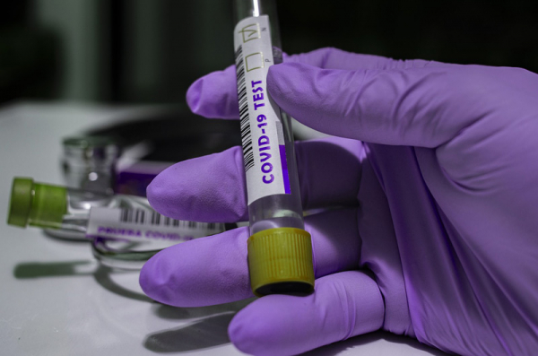 Testy odhalily v neděli dalších 4 557 nakažených koronavirem