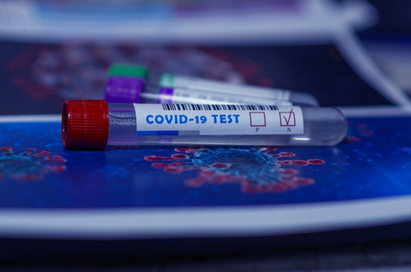 Praha žádá ministerstvo školství o urychlené proplacení PCR testů z jara